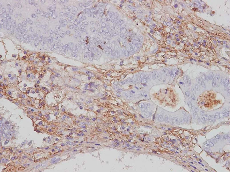 CTLA4 Polyclonal Antibody - image 1