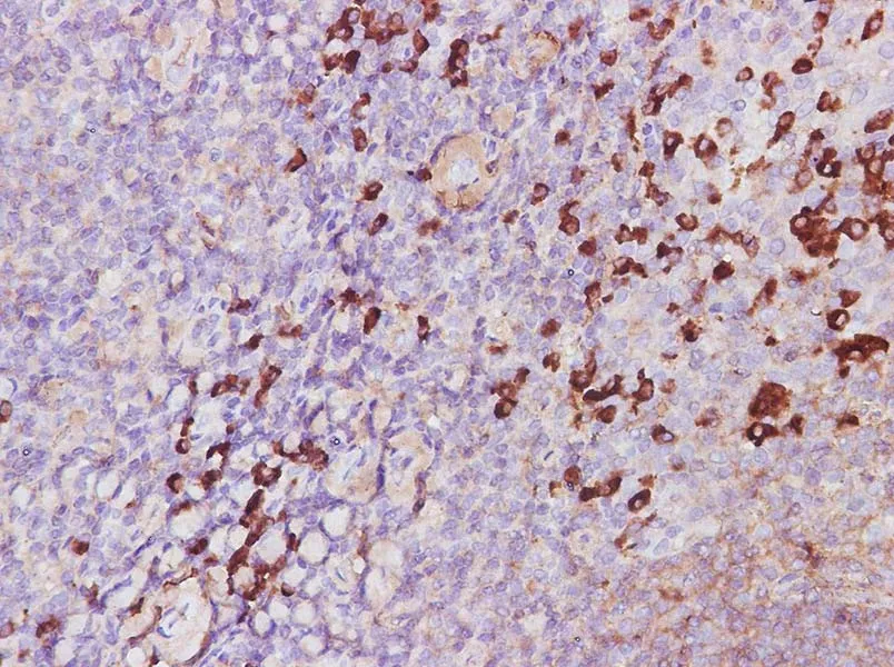 CTLA4 Polyclonal Antibody - image 2