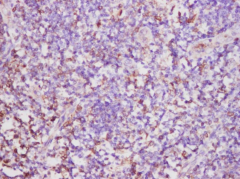 CD74 Polyclonal Antibody - image 1