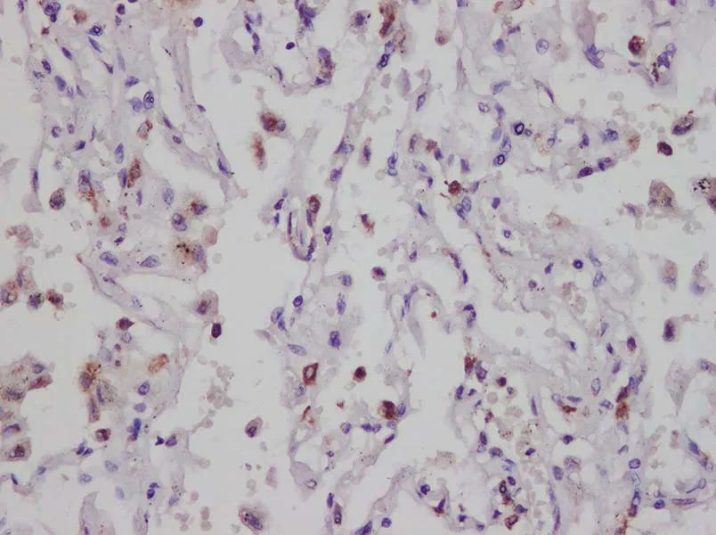 CD74 Polyclonal Antibody - image 2