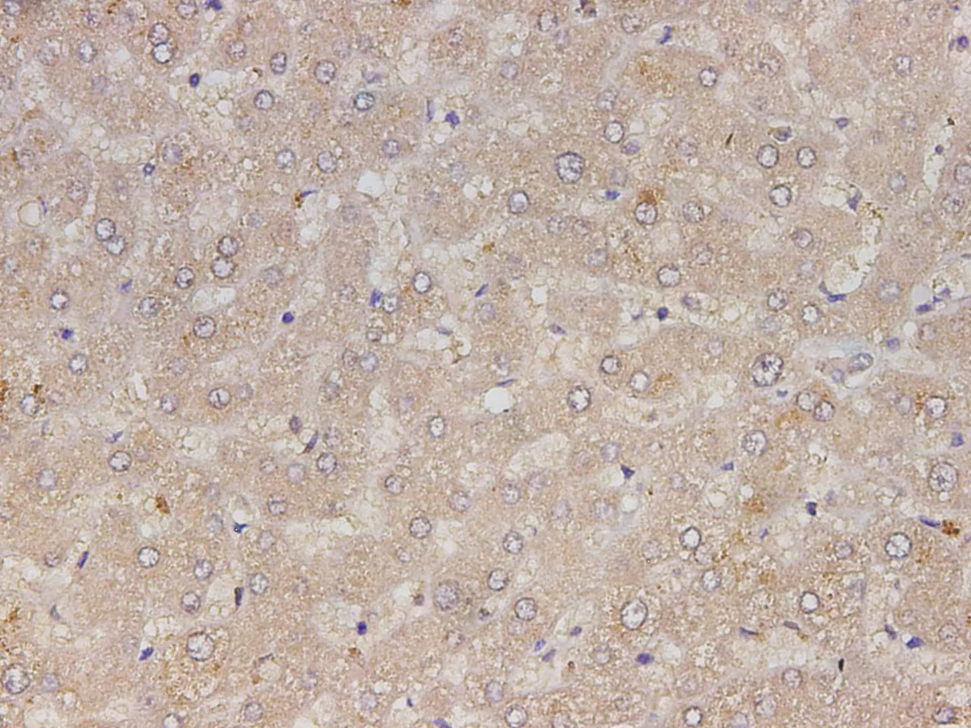 RETN Polyclonal Antibody - image 1