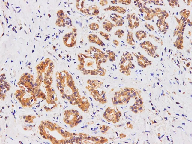 AMPK alpha2 Polyclonal Antibody - image 2