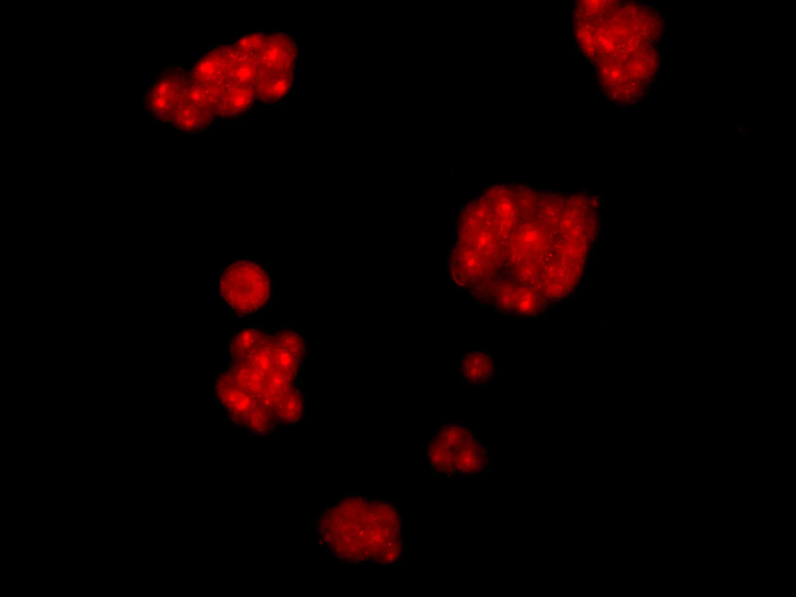AMPK alpha2 Polyclonal Antibody - image 3