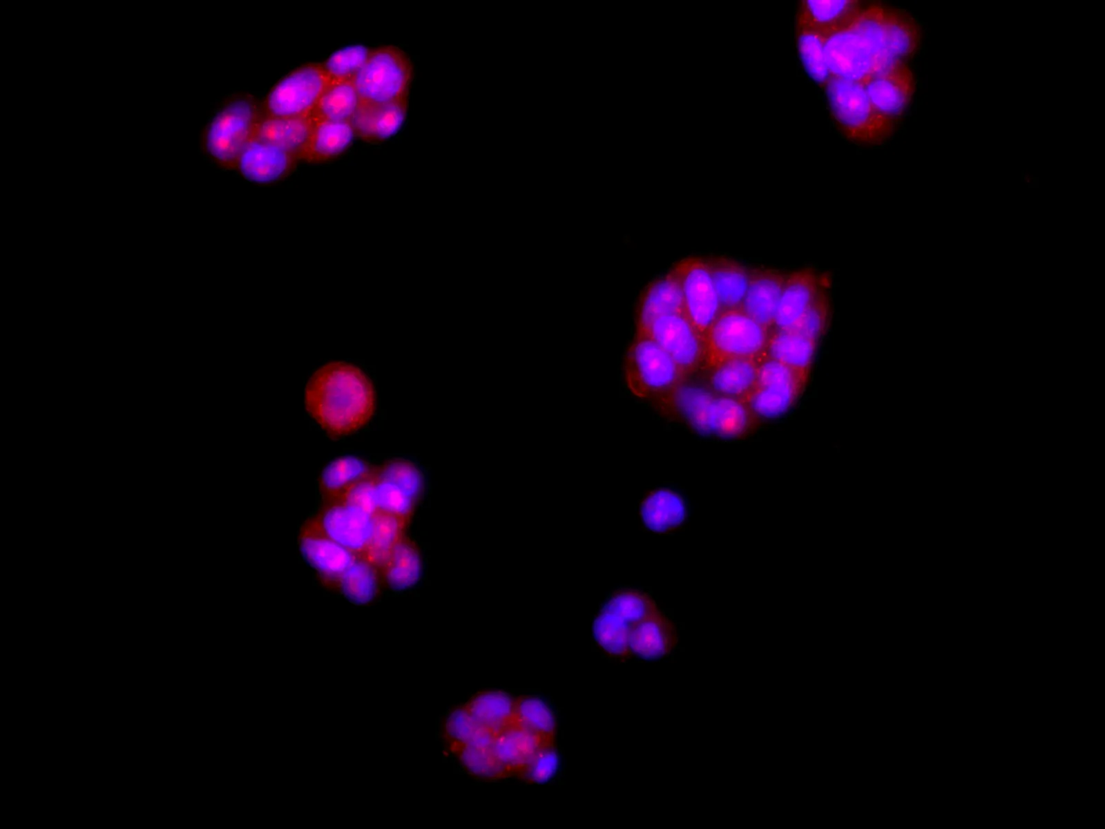 AMPK alpha2 Polyclonal Antibody - image 4