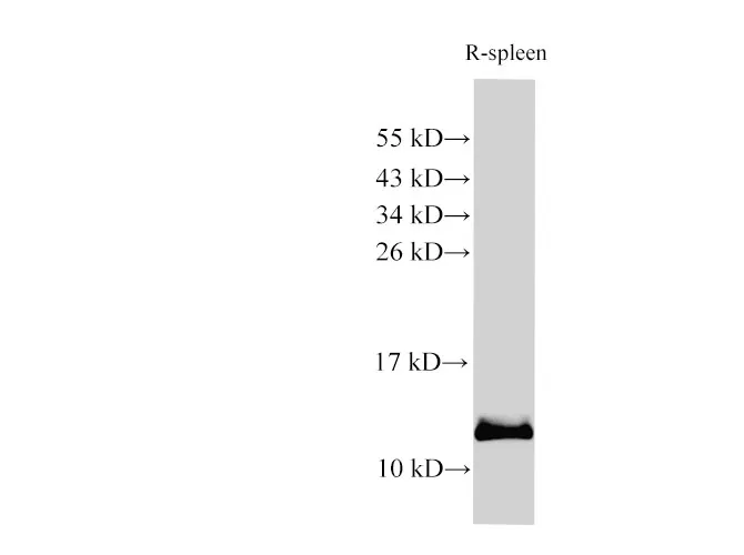 S100A9 Polyclonal Antibody - image 1