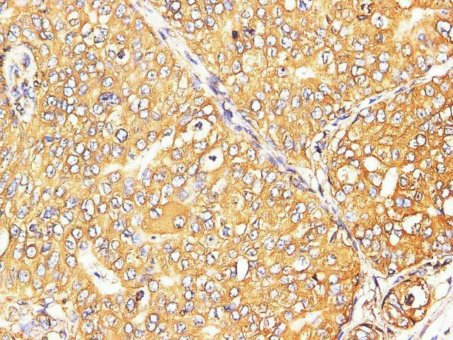 S100A9 Polyclonal Antibody - image 2