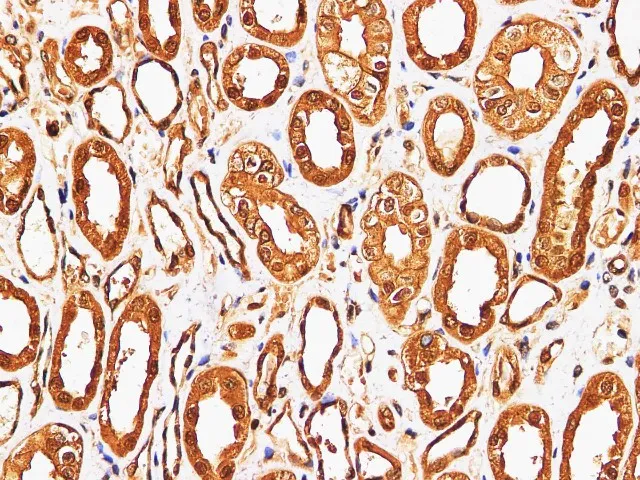 S100A9 Polyclonal Antibody - image 3
