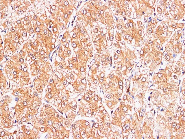 S100A9 Polyclonal Antibody - image 4