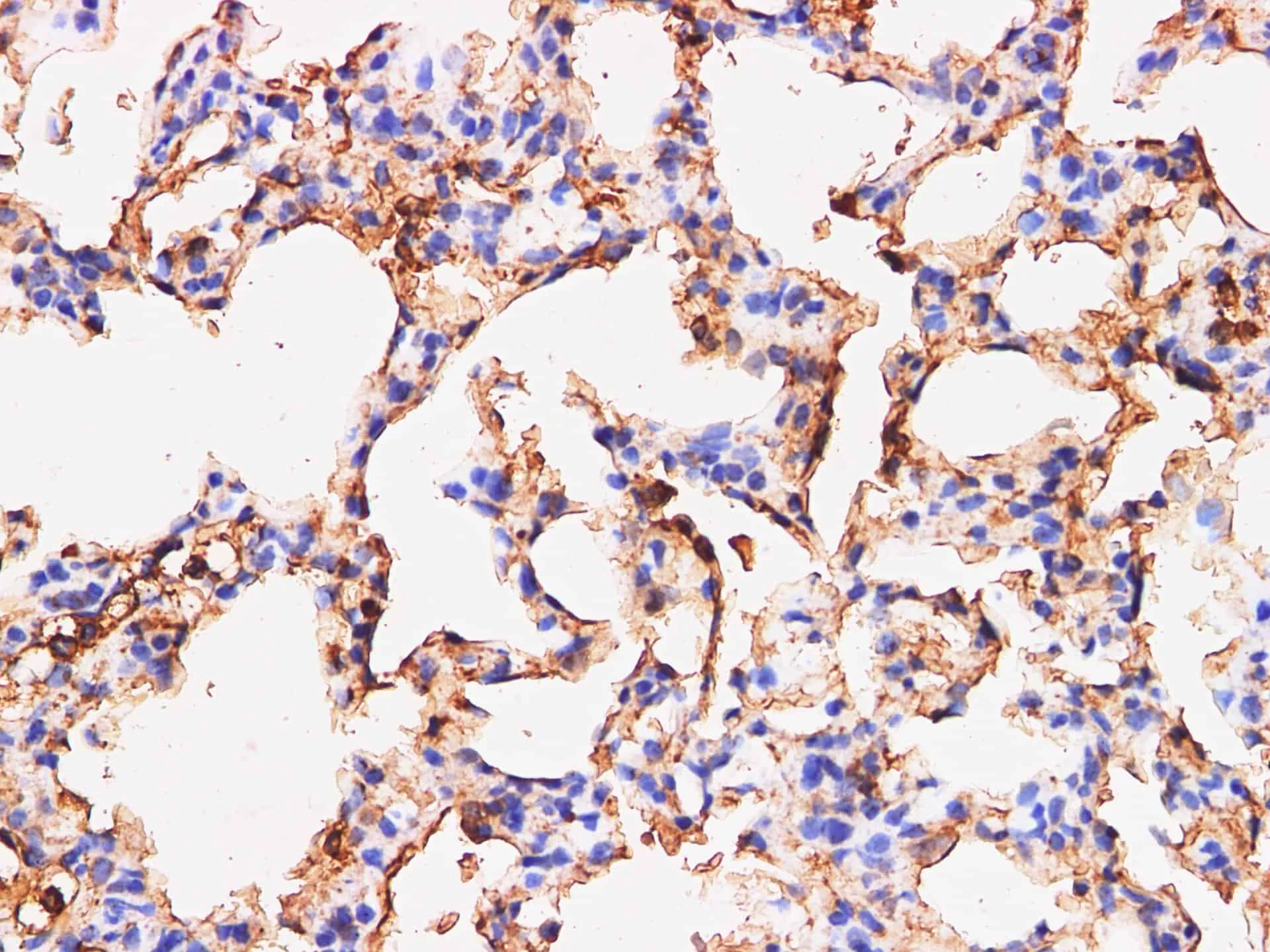 S100A9 Polyclonal Antibody - image 5