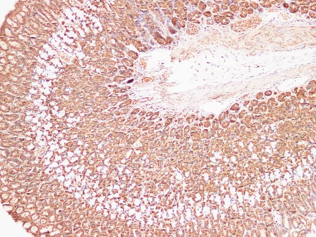 S100A9 Polyclonal Antibody - image 6