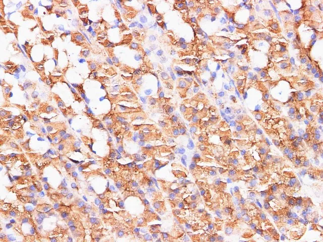 S100A9 Polyclonal Antibody - image 7