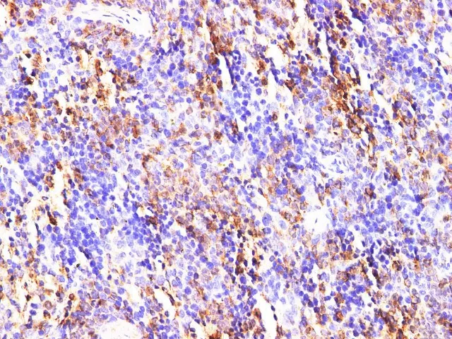 S100A9 Polyclonal Antibody - image 8