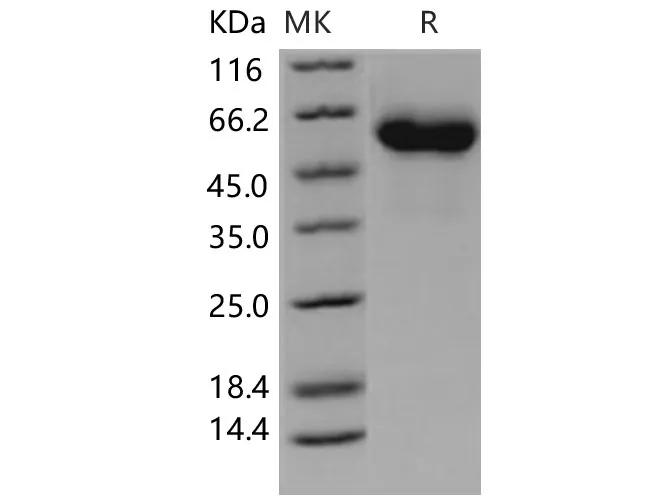 Recombinant Human Complement Factor H/CFH protein (His tag) - image 1