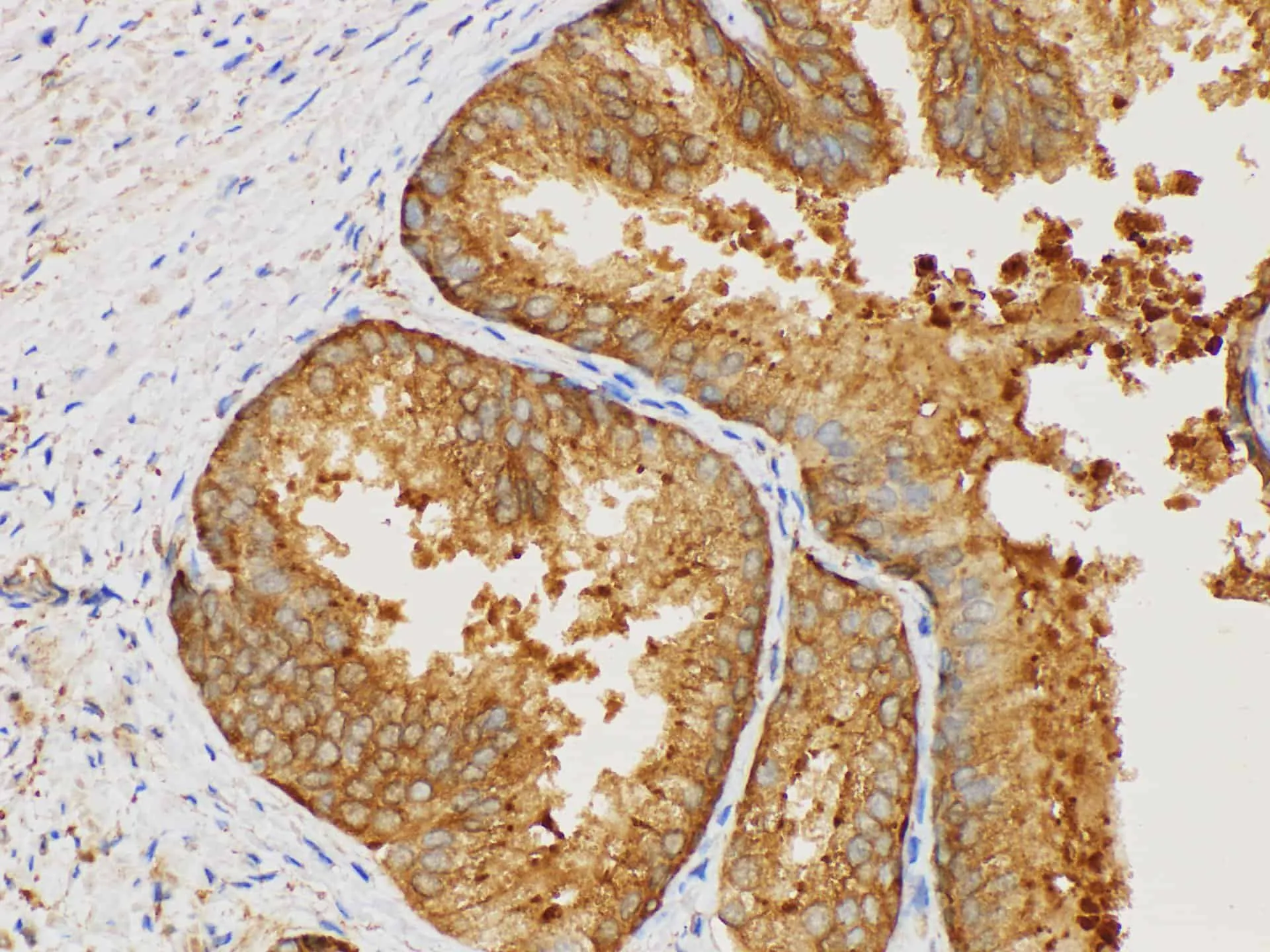 MIF Polyclonal Antibody - image 3