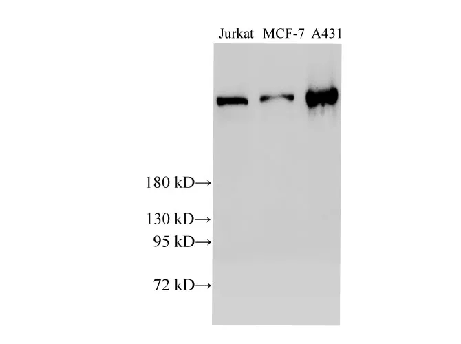 BRCA2 Polyclonal Antibody - image 1