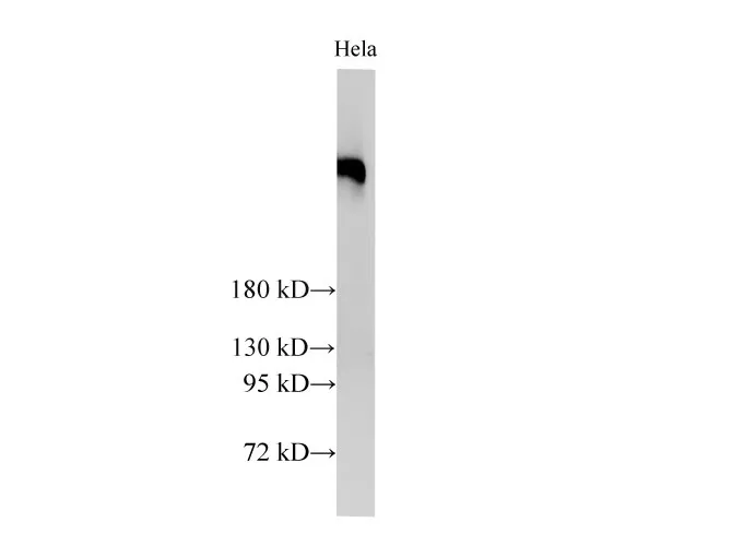BRCA2 Polyclonal Antibody - image 2