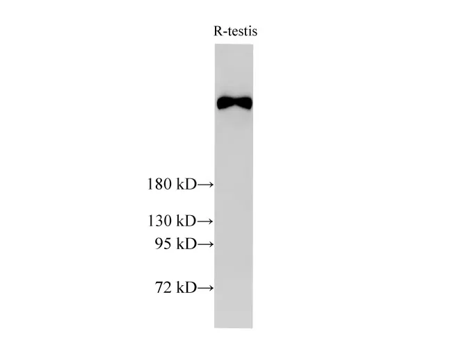 BRCA2 Polyclonal Antibody - image 3