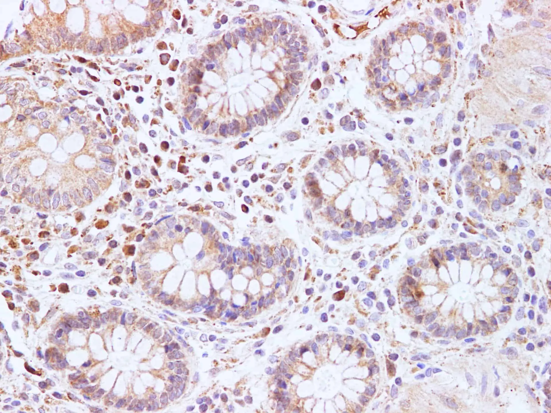 BRCA2 Polyclonal Antibody - image 4