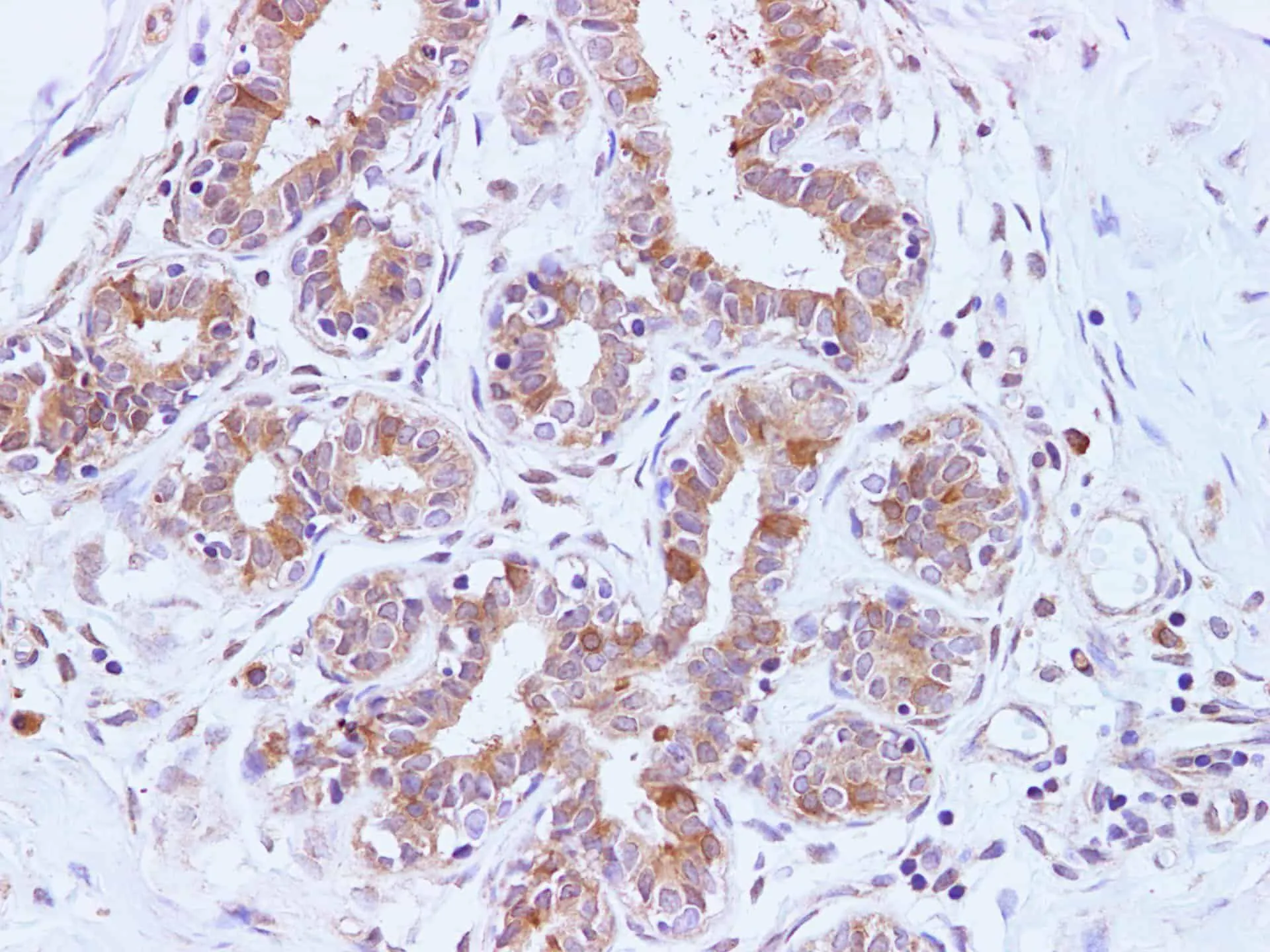 BRCA2 Polyclonal Antibody - image 5