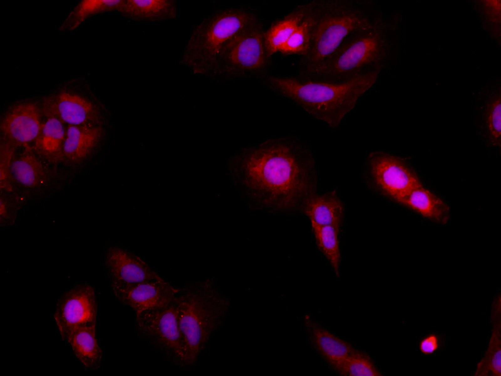 BRCA2 Polyclonal Antibody - image 6