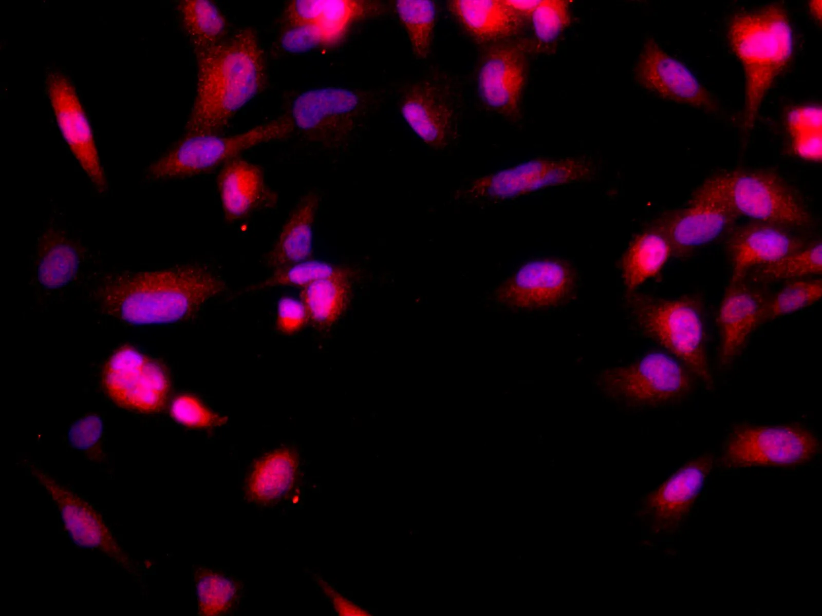 BRCA2 Polyclonal Antibody - image 7