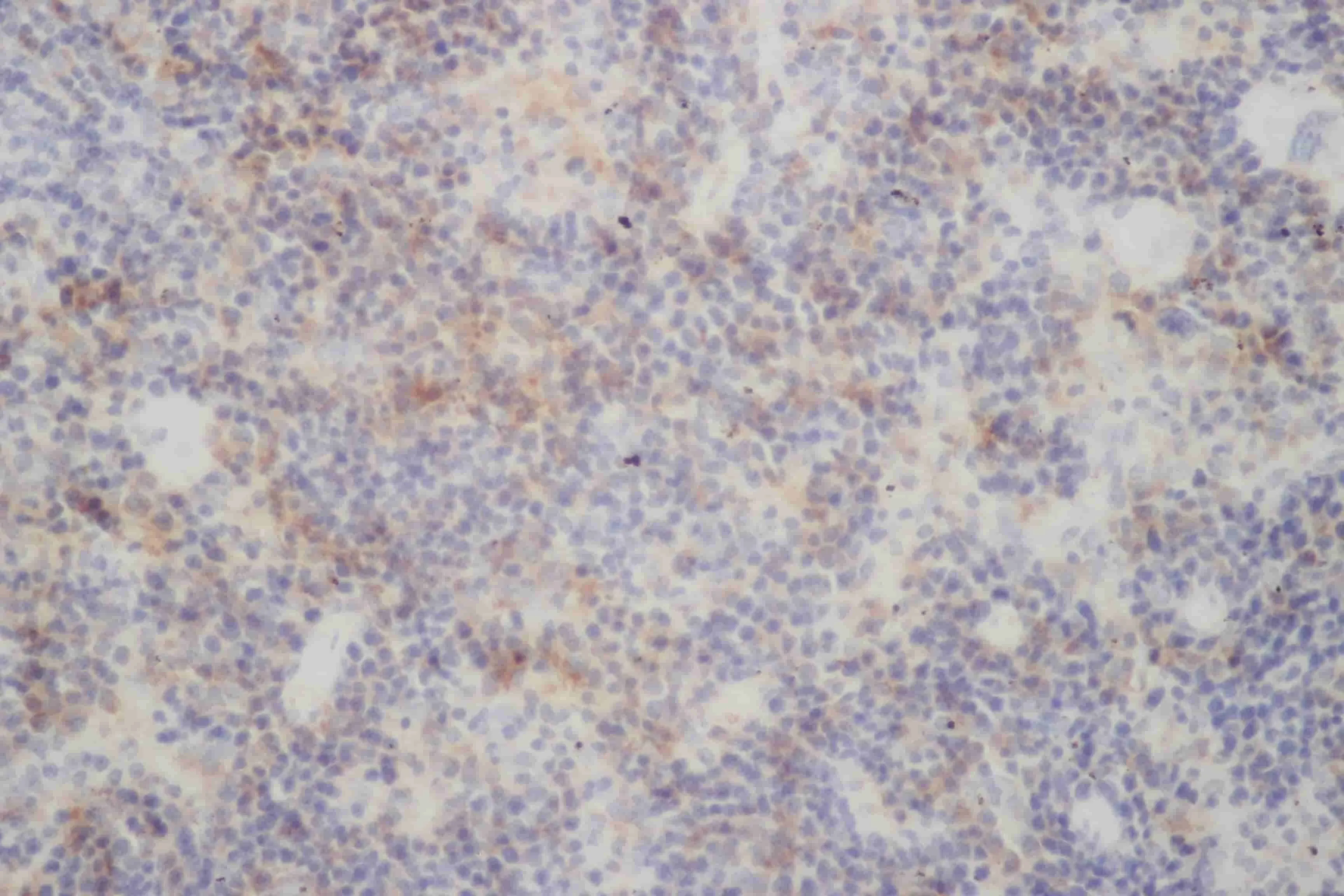 RELB Polyclonal Antibody - image 2