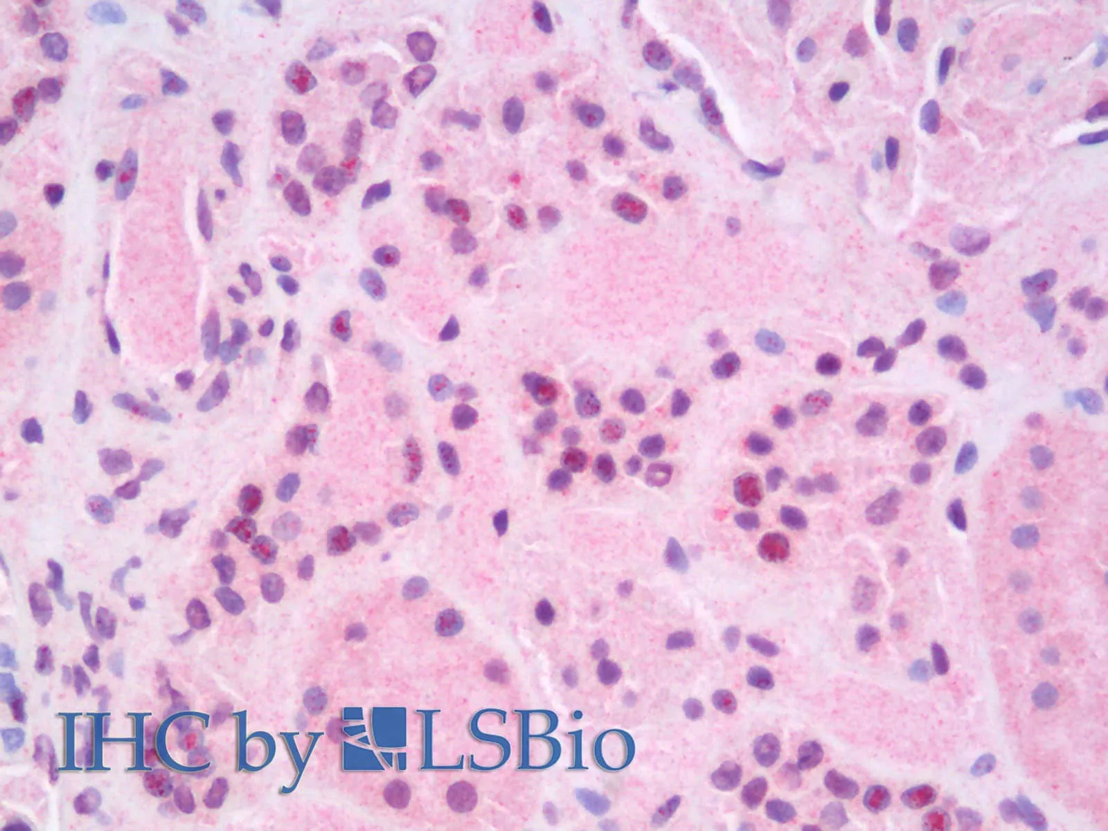 RELB Polyclonal Antibody - image 3