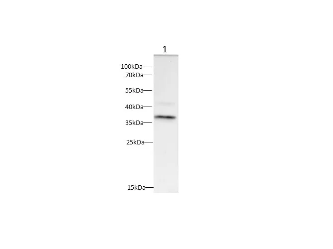 CD20 Polyclonal Antibody - image 1