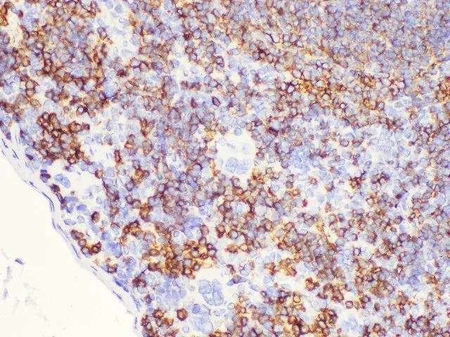 CD20 Polyclonal Antibody - image 2