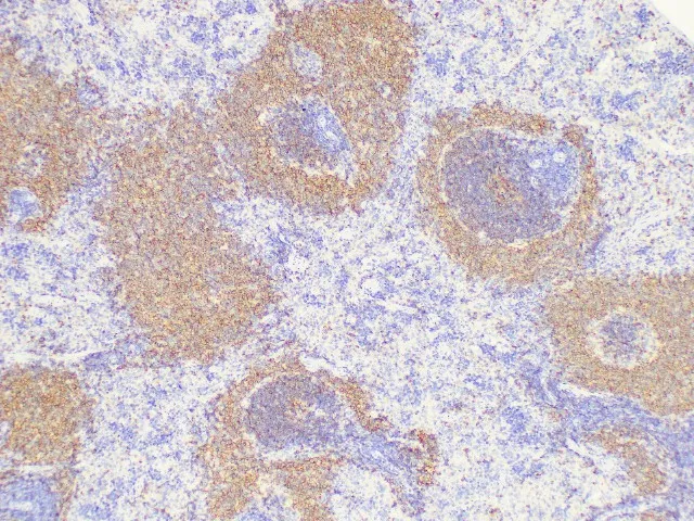 CD20 Polyclonal Antibody - image 3
