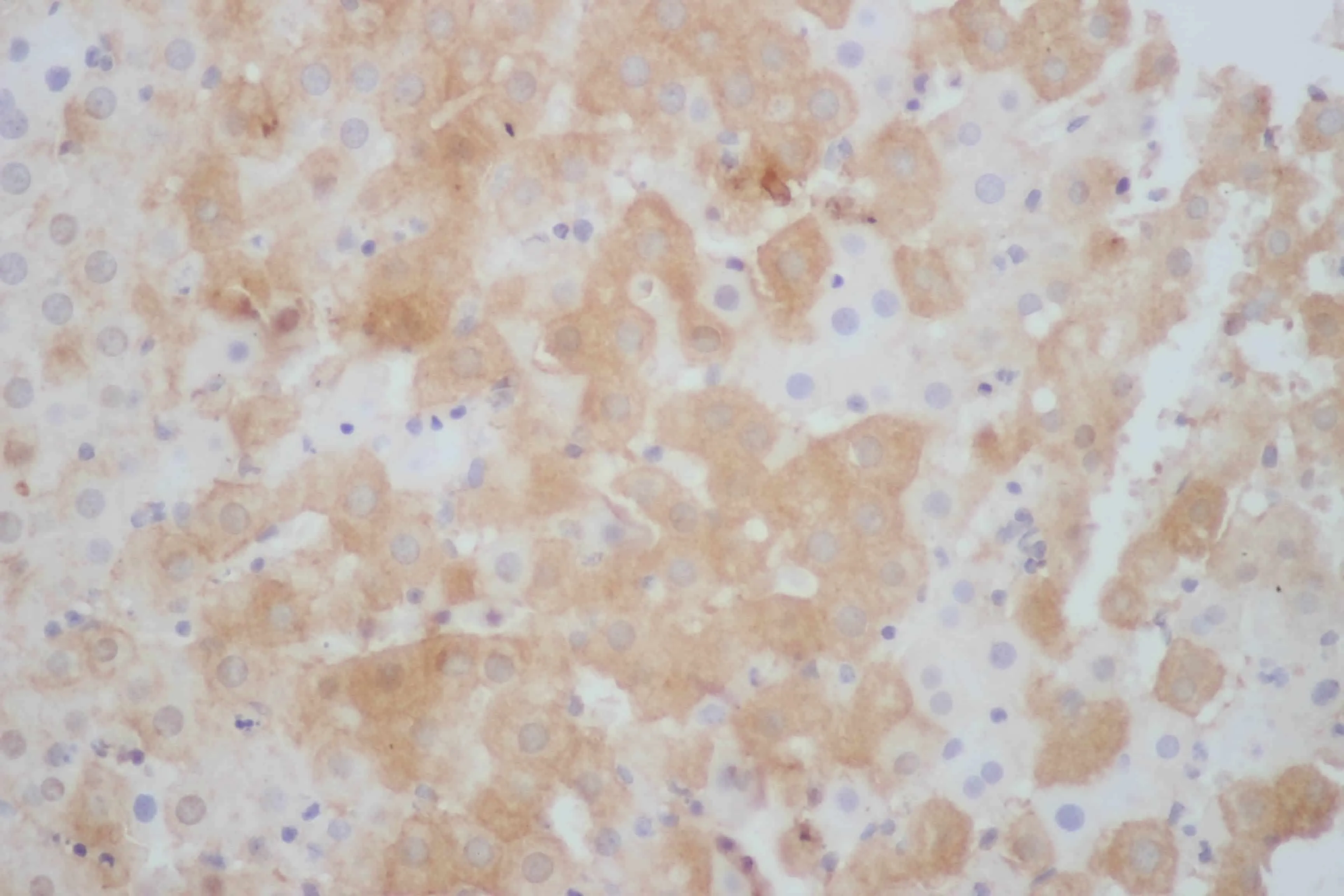 STAT1 Polyclonal Antibody - image 3