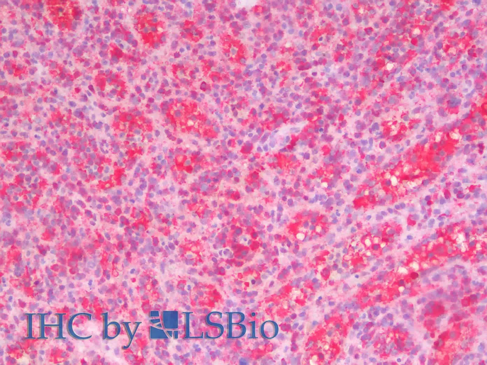STAT1 Polyclonal Antibody - image 4