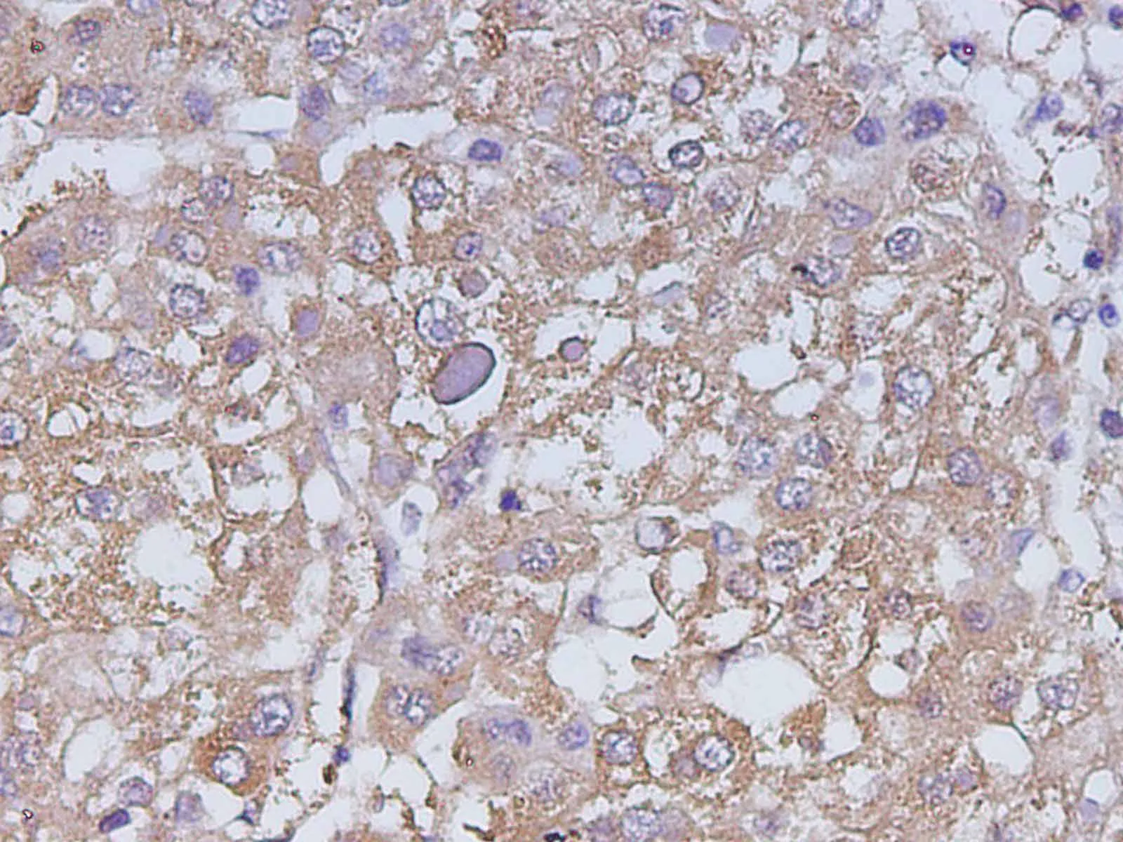 CA199 Polyclonal Antibody - image 1