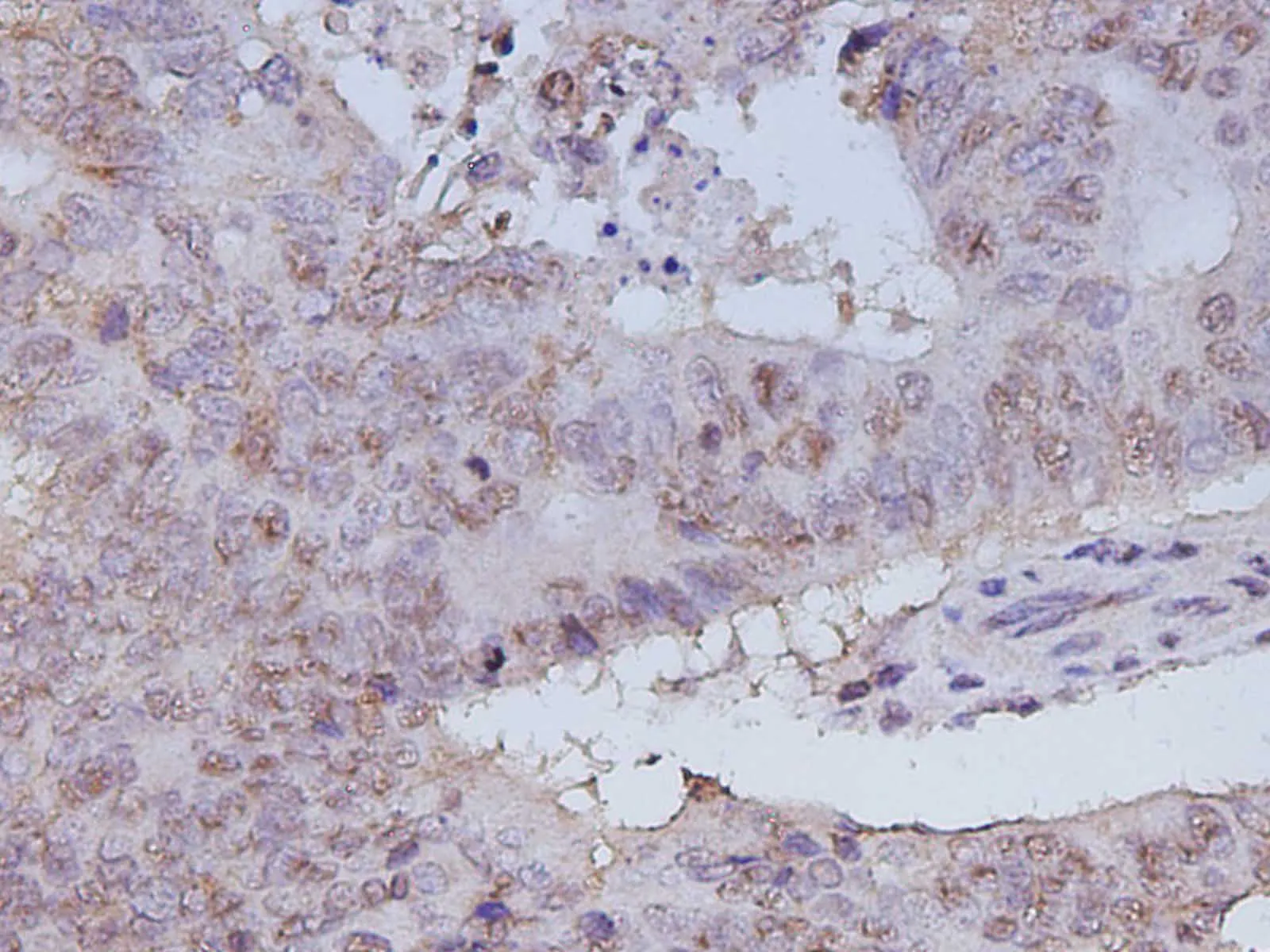 CA199 Polyclonal Antibody - image 2