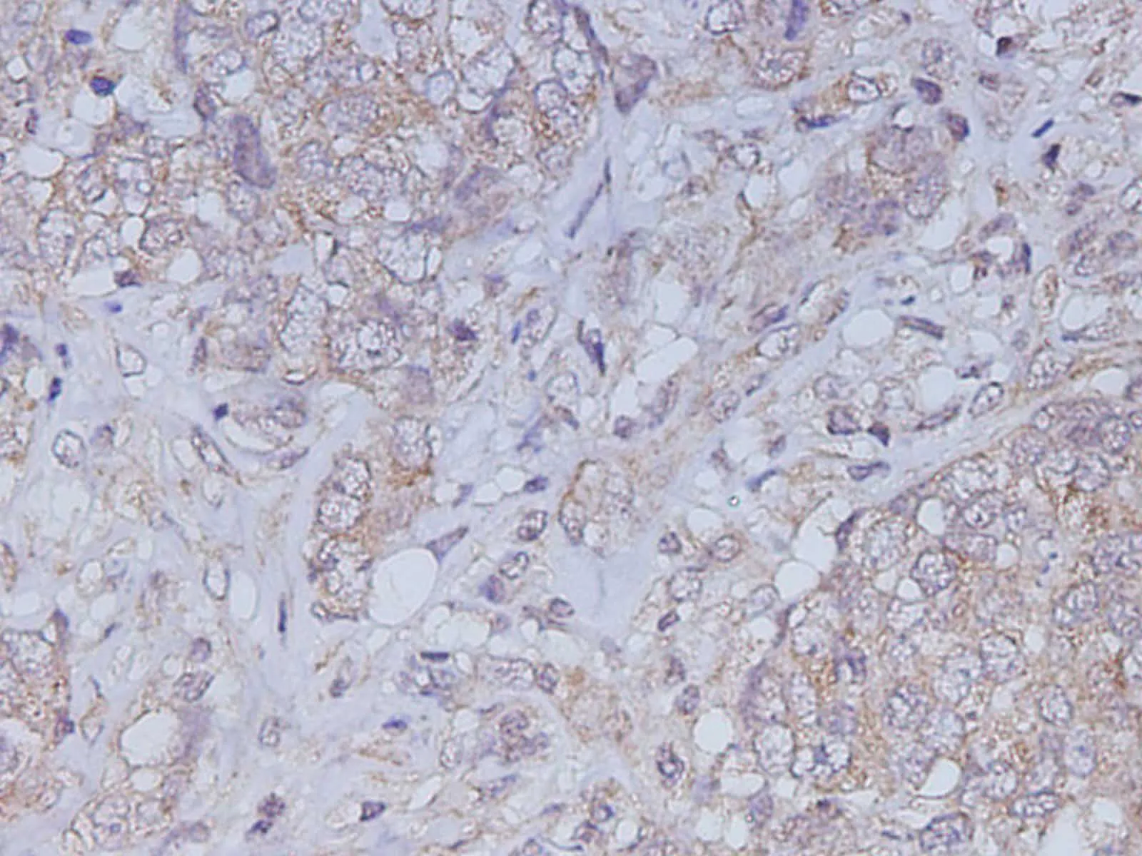 CA199 Polyclonal Antibody - image 3