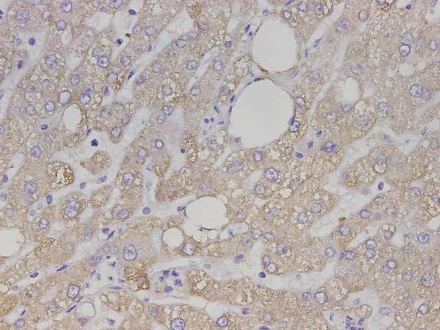 Maoa Polyclonal Antibody - image 2