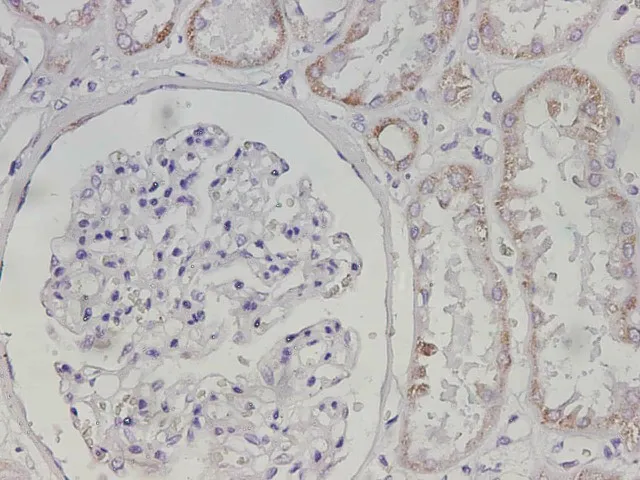 Maoa Polyclonal Antibody - image 3