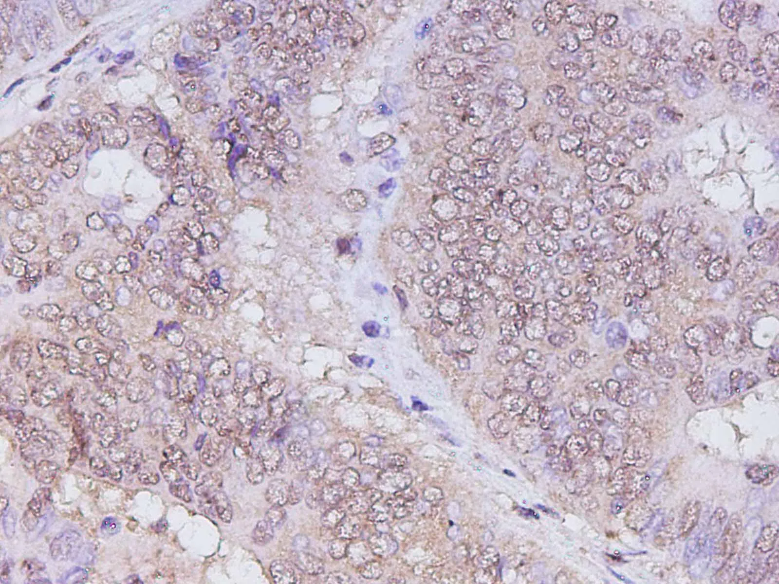 RUNX2 Polyclonal Antibody - image 2
