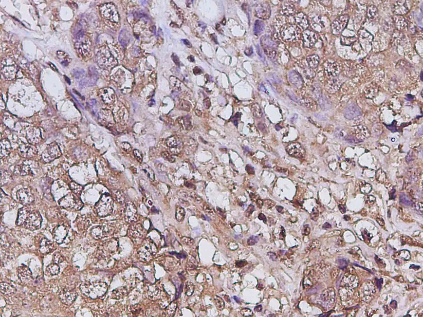 RUNX2 Polyclonal Antibody - image 3