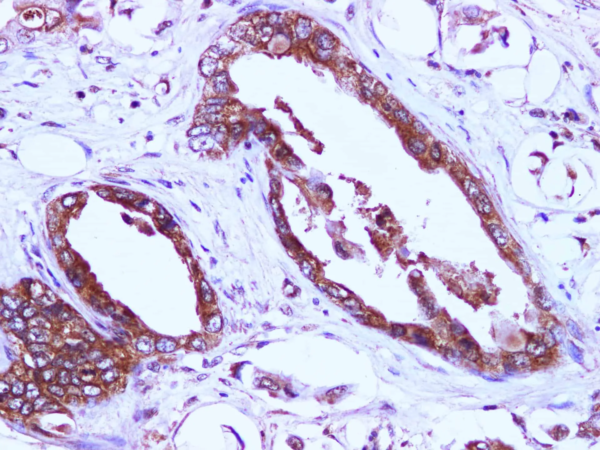 EIF4EBP1 Polyclonal Antibody - image 1