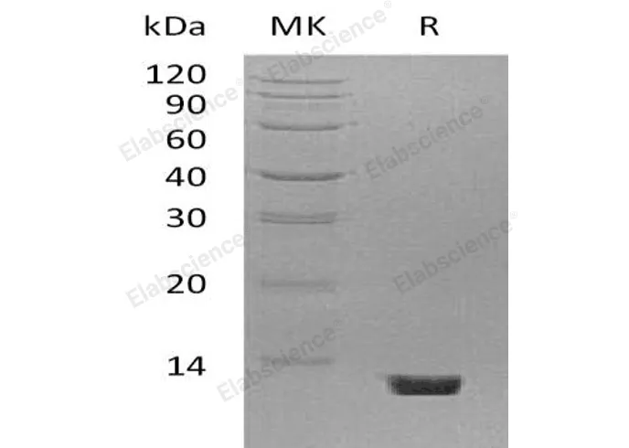 Recombinant Mouse Complement Component C5/C5 Protein - image 2