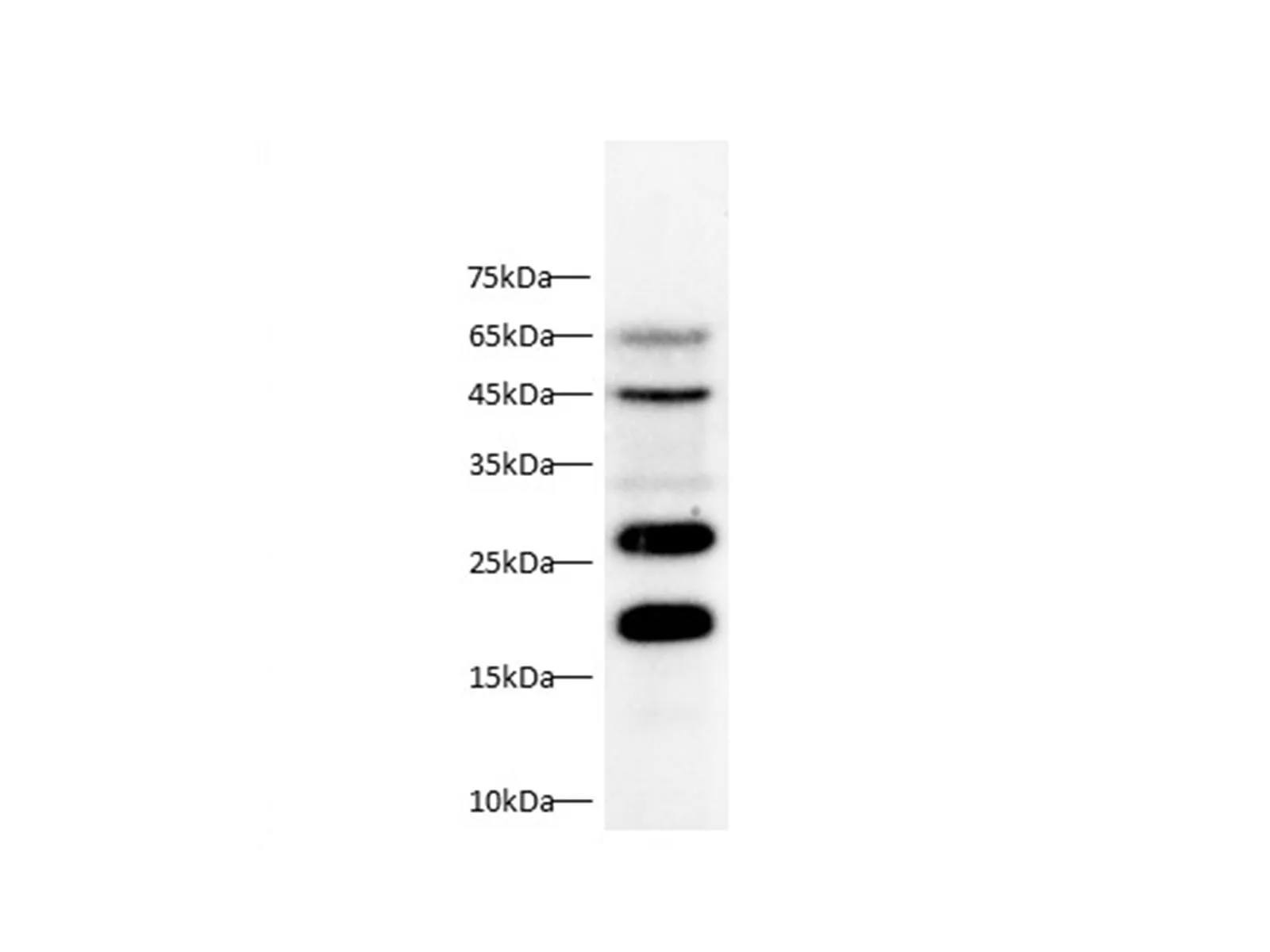 CTSB Polyclonal Antibody - image 1