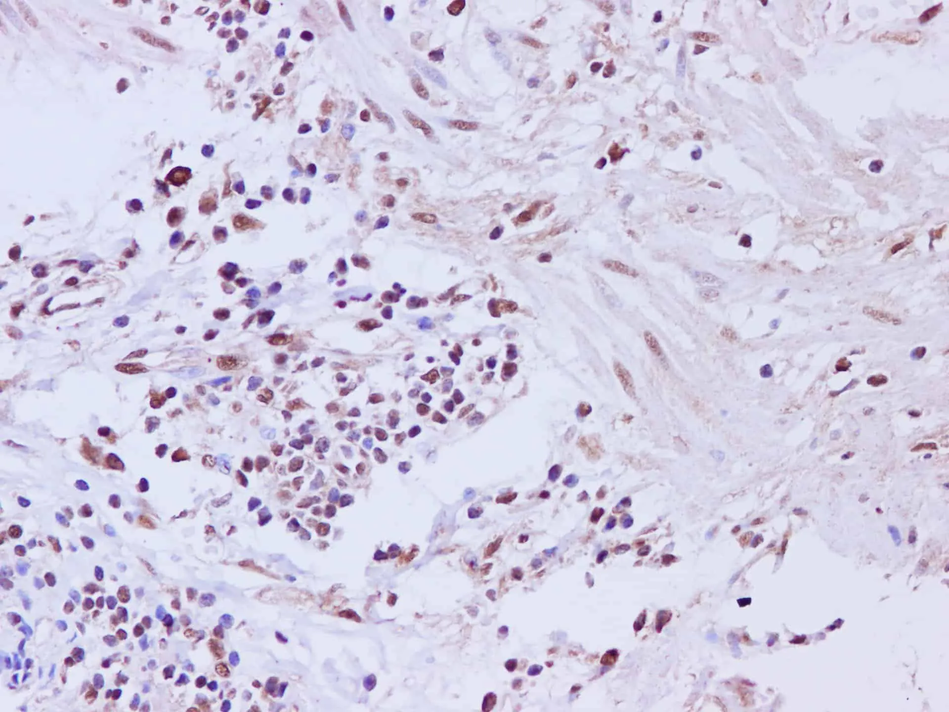 CCNL2 Polyclonal Antibody - image 1