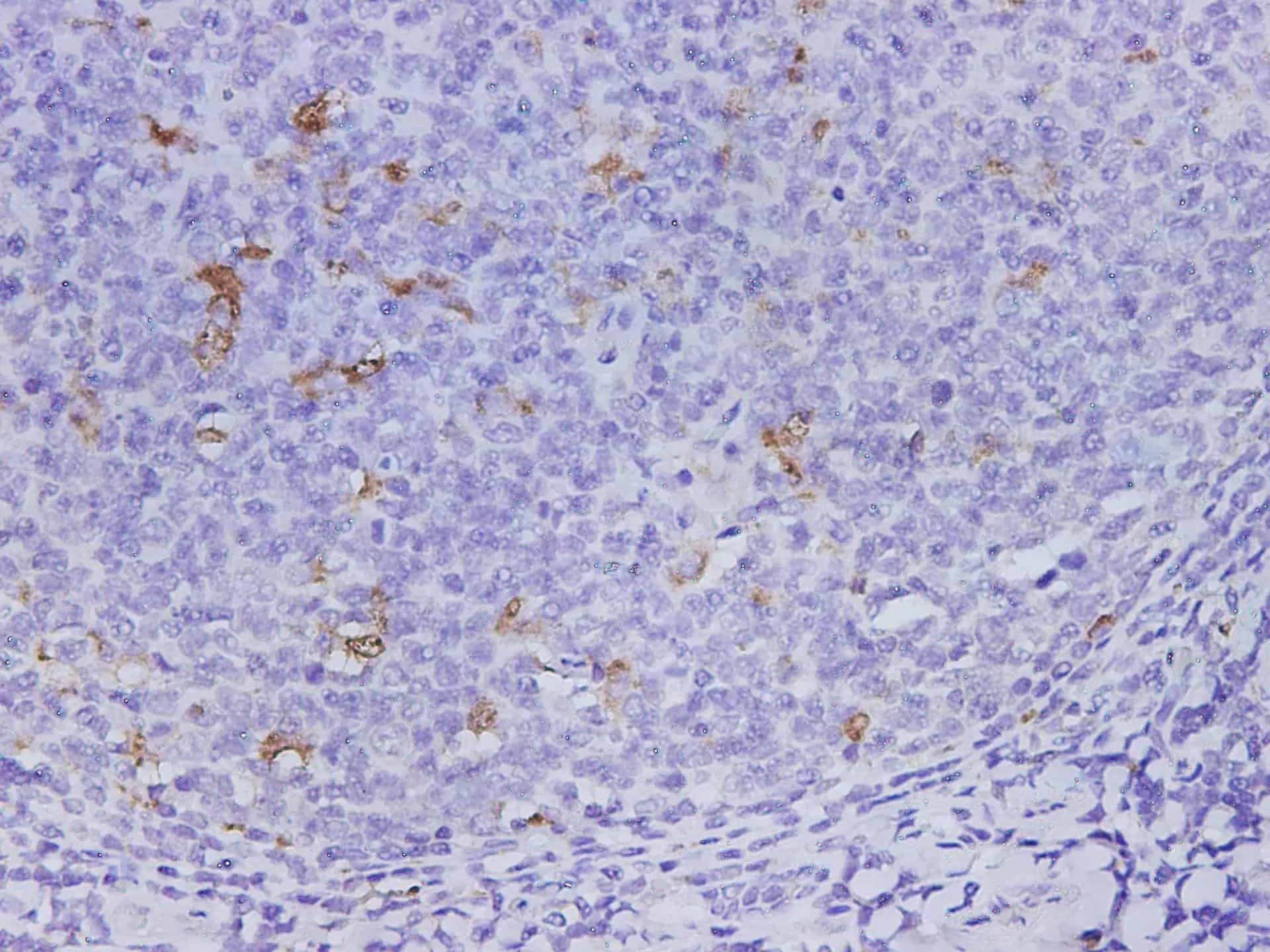 CD68 Polyclonal Antibody - image 1