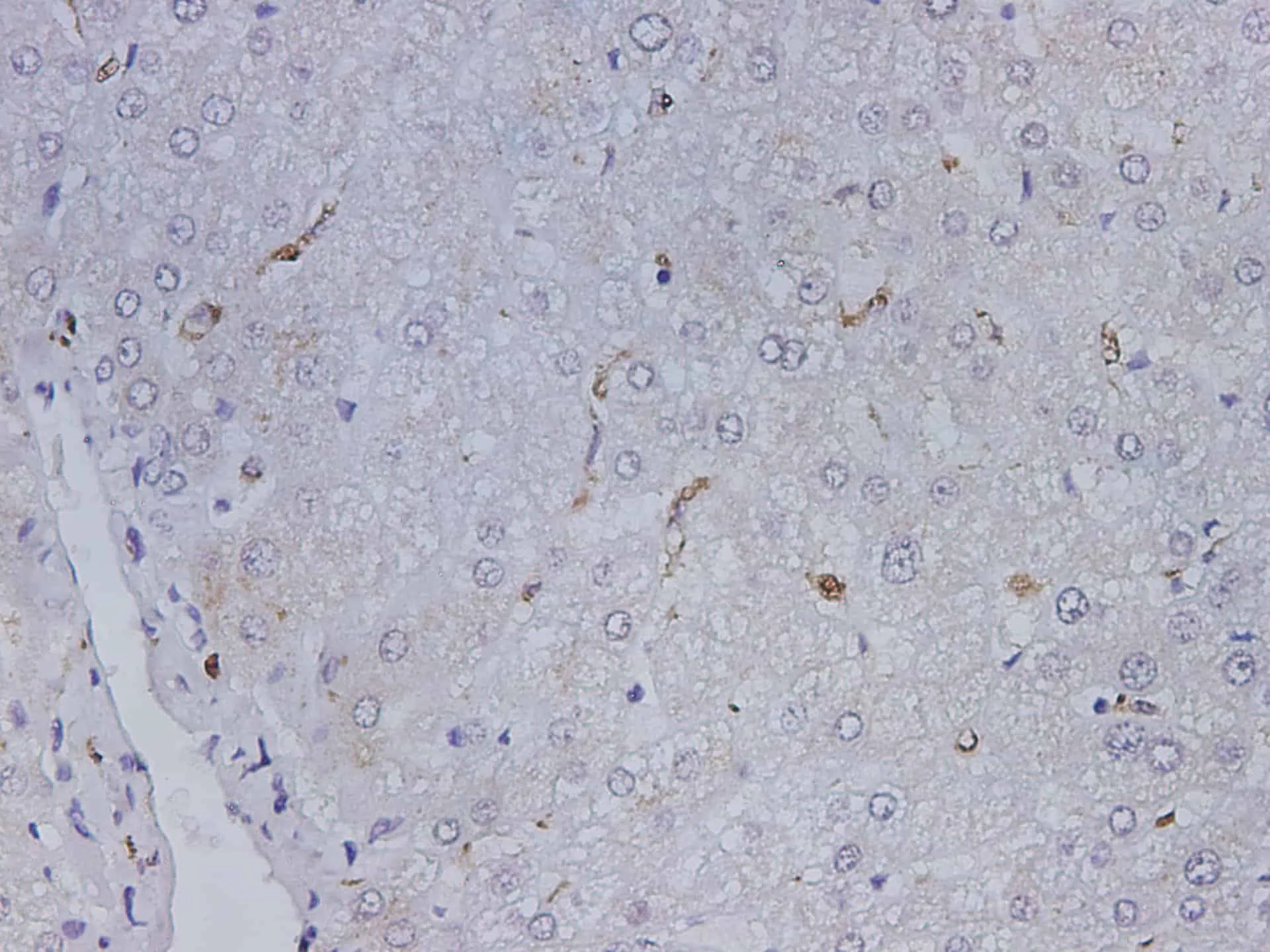 CD68 Polyclonal Antibody - image 2