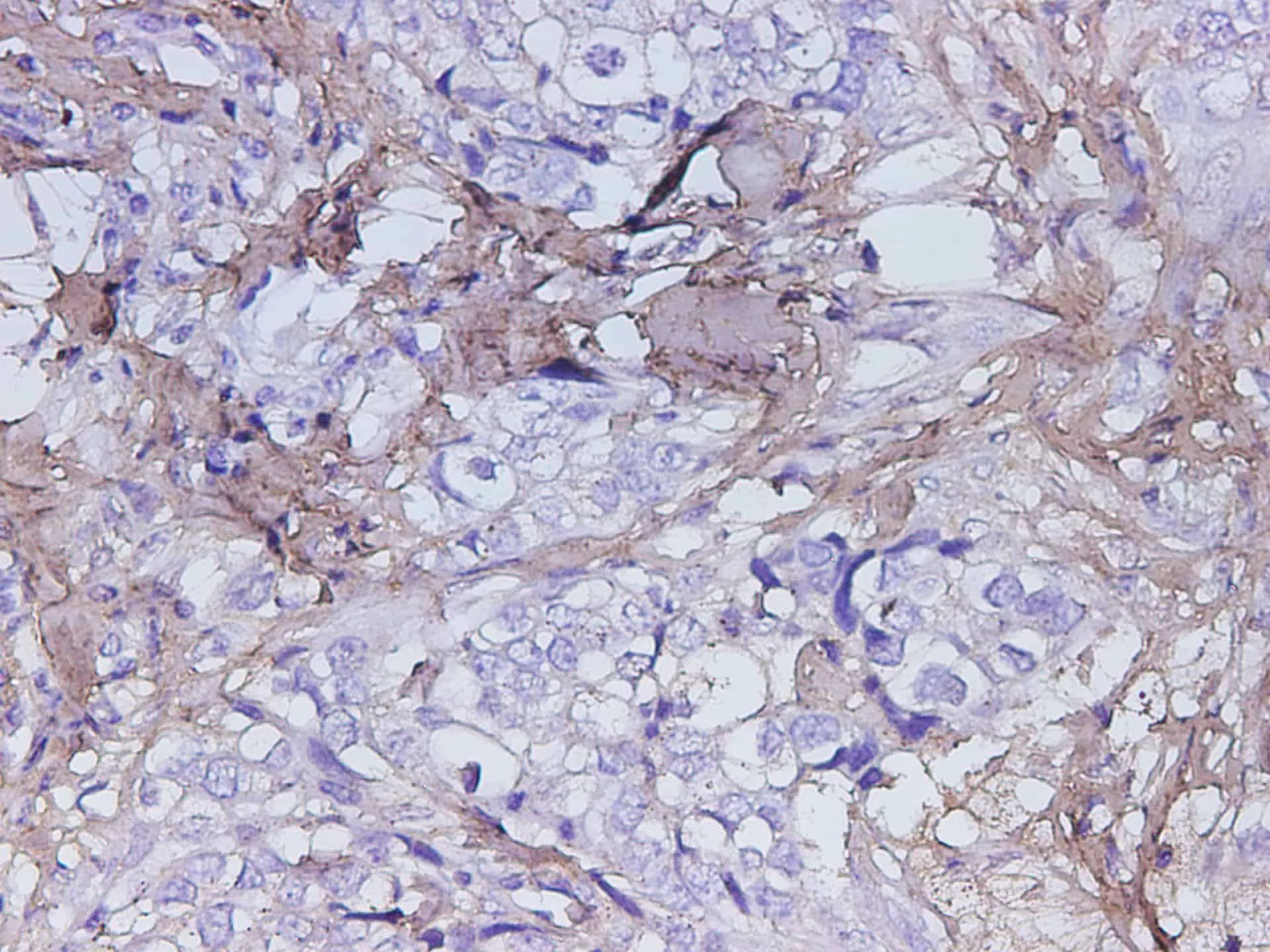 POSTN Polyclonal Antibody - image 1
