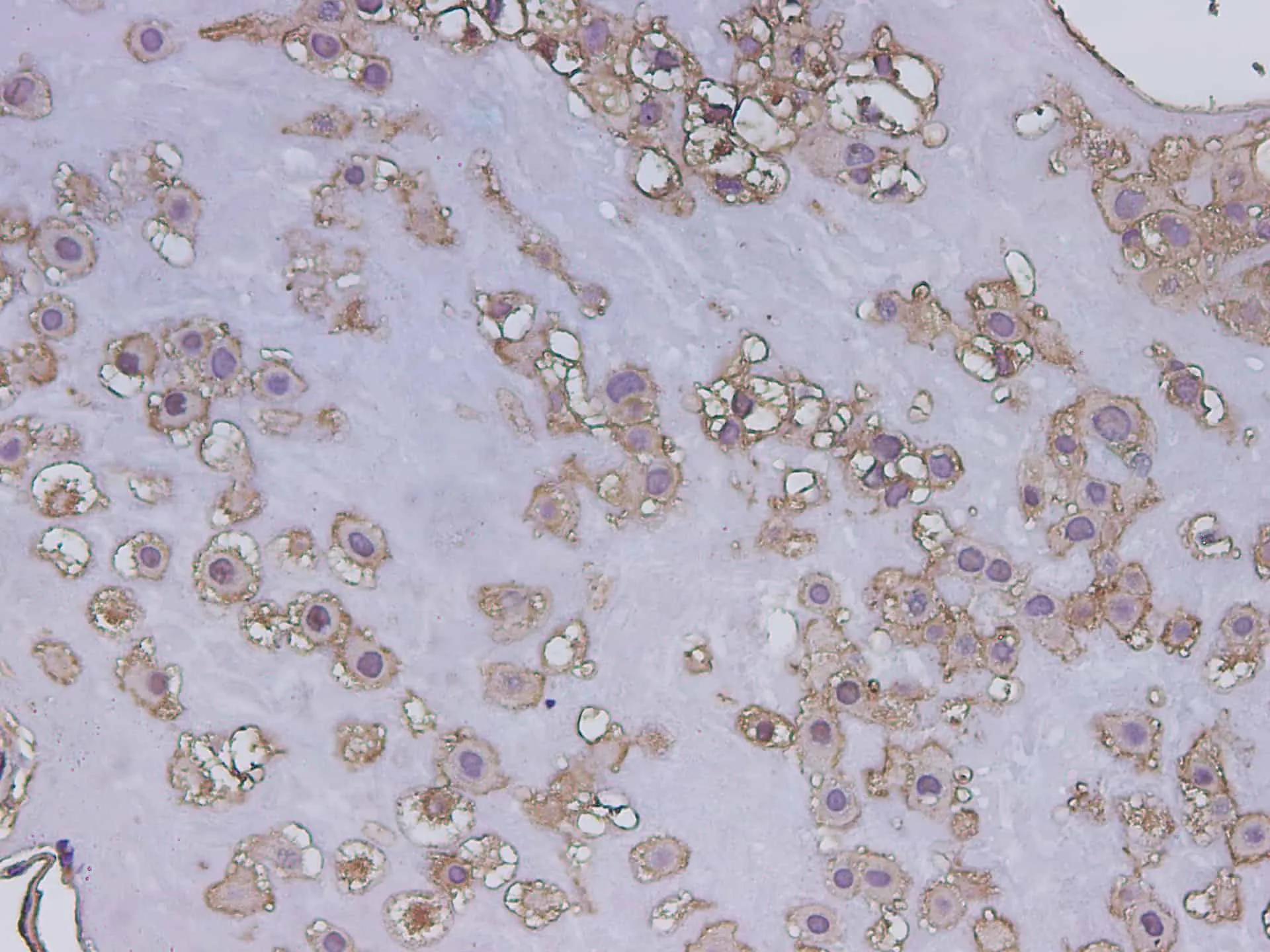 POSTN Polyclonal Antibody - image 2