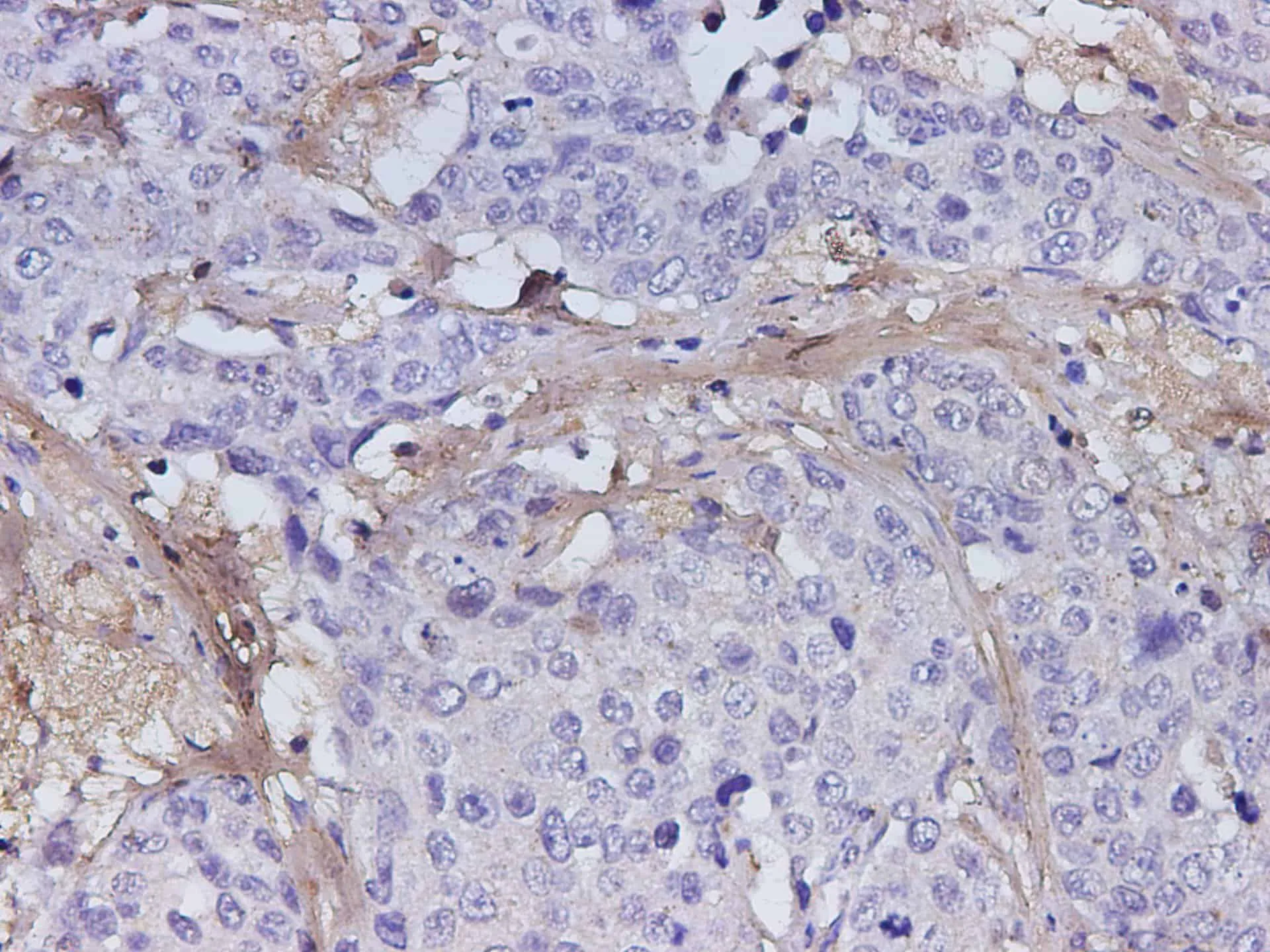 POSTN Polyclonal Antibody - image 3