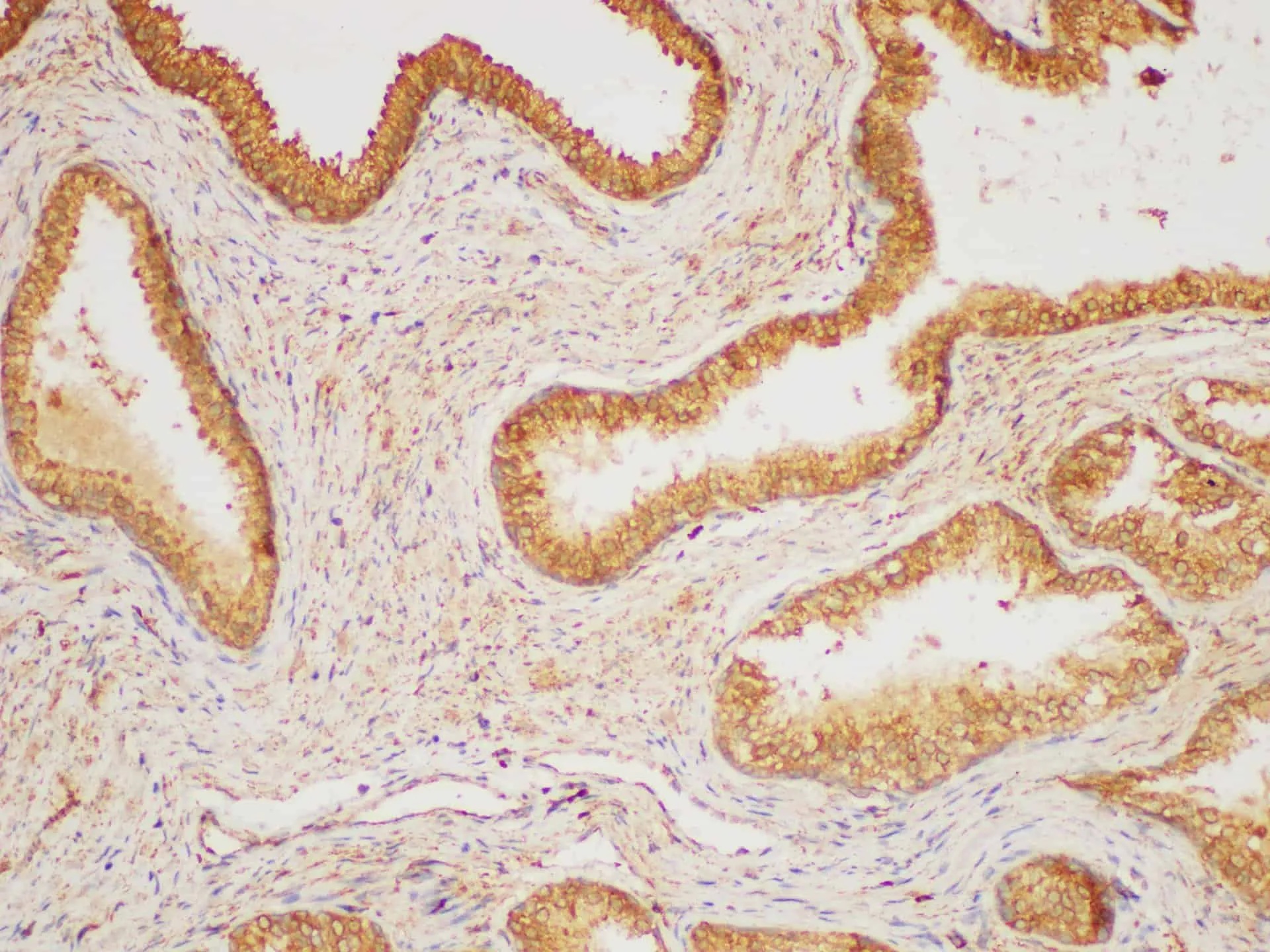 HRAS Polyclonal Antibody - image 1