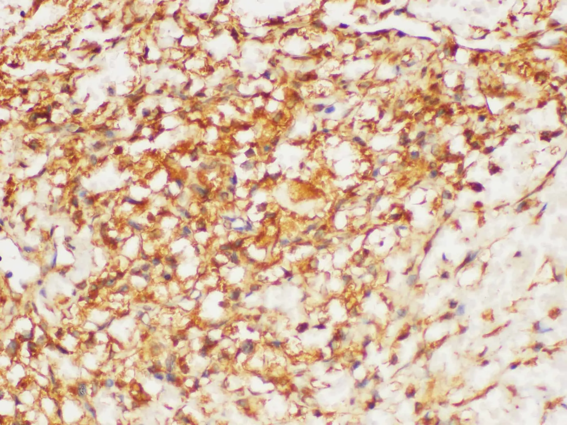 HRAS Polyclonal Antibody - image 2